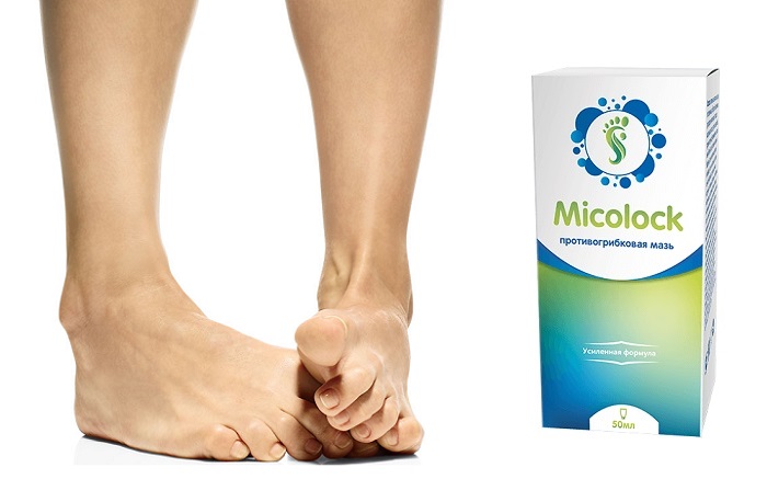 Micolock от грибка ногтей и ног: мощное средство, моментально заживляющее кожу!