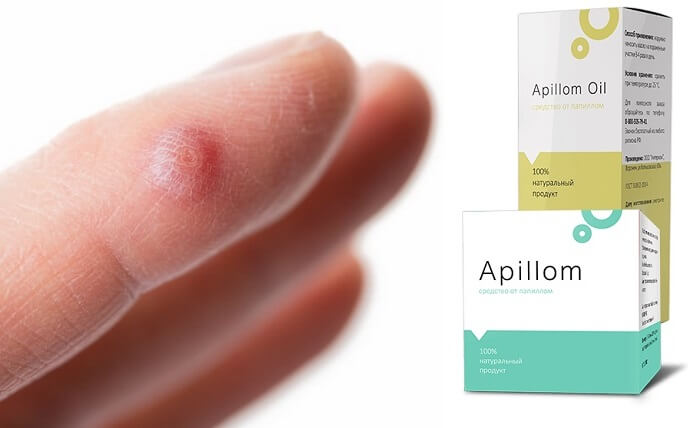 Apillom Oil средство от папиллом и бородавок: чистая и гладкая кожа за 30 дней!
