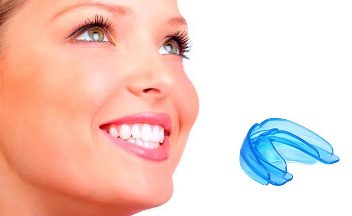 G-TOOTH TRAINER для выпрямления зубов: лучшая альтернатива специализированным дорогостоящим процедурам!