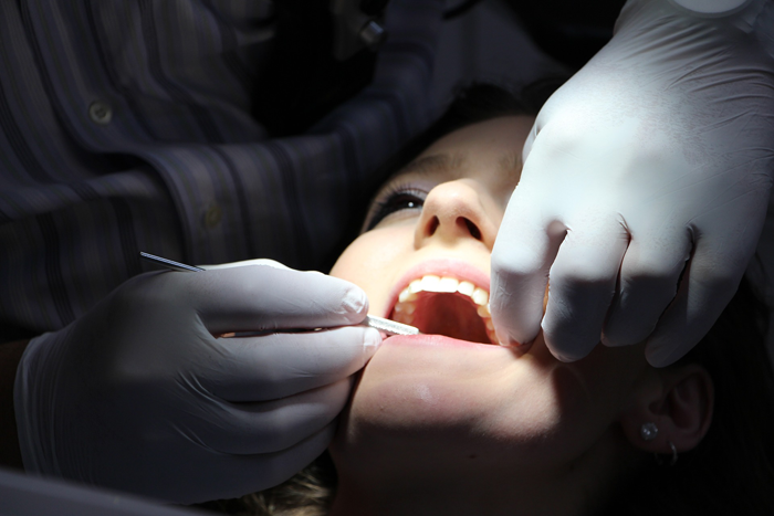 5 способов сделать зубы белее, не прибегая к отбеливанию