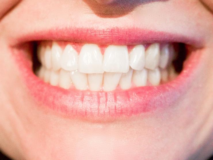 5 секретов здоровых зубов